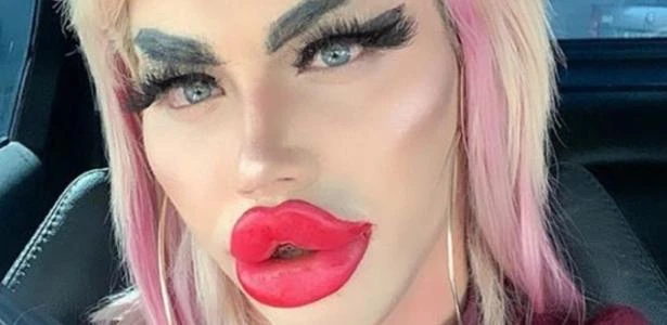 Homem gasta R$ 110 mil para parecer Barbie, mas diz não conseguir namorada