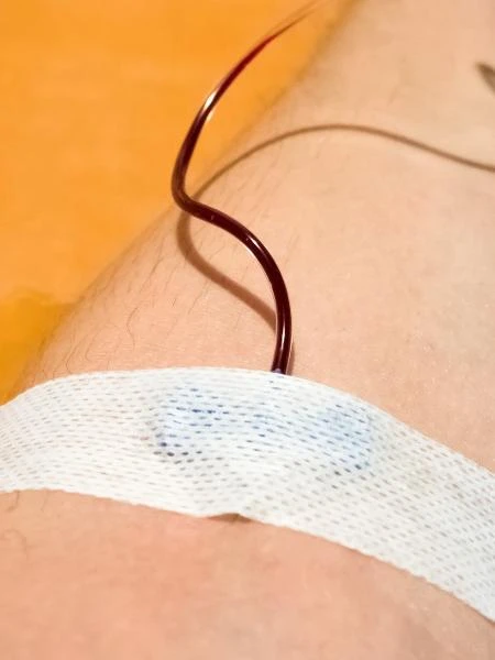 Justiça manda SP pagar transplante sem transfusão a testemunha de Jeová
