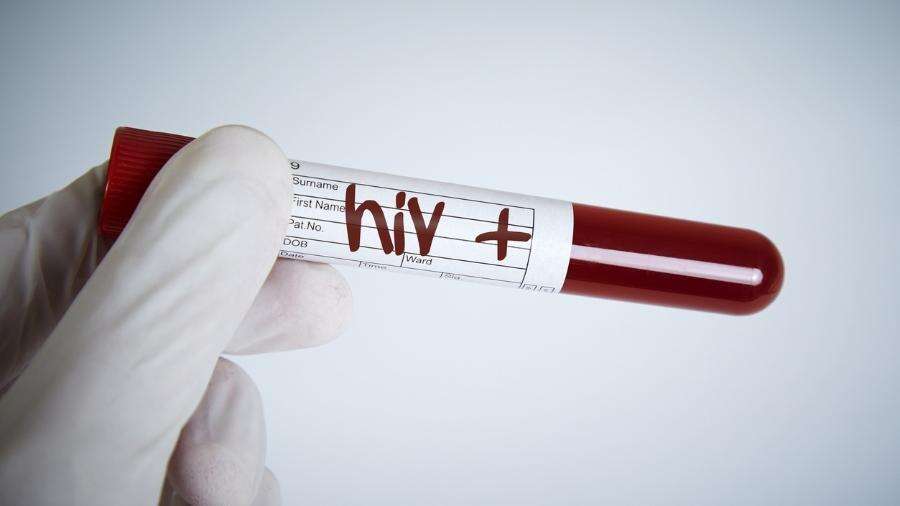 HIV em transplantados: laboratório receberia R$ 11 milhões do governo do RJ