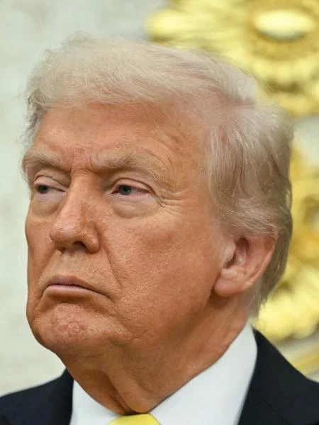 Autismo e paracetamol: o que diz novo estudo sobre uso de remédio por grávidas