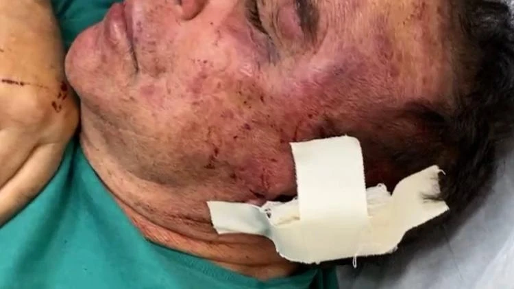 Candidato a prefeito na PB tem casa invadida e é espancado por bandidos