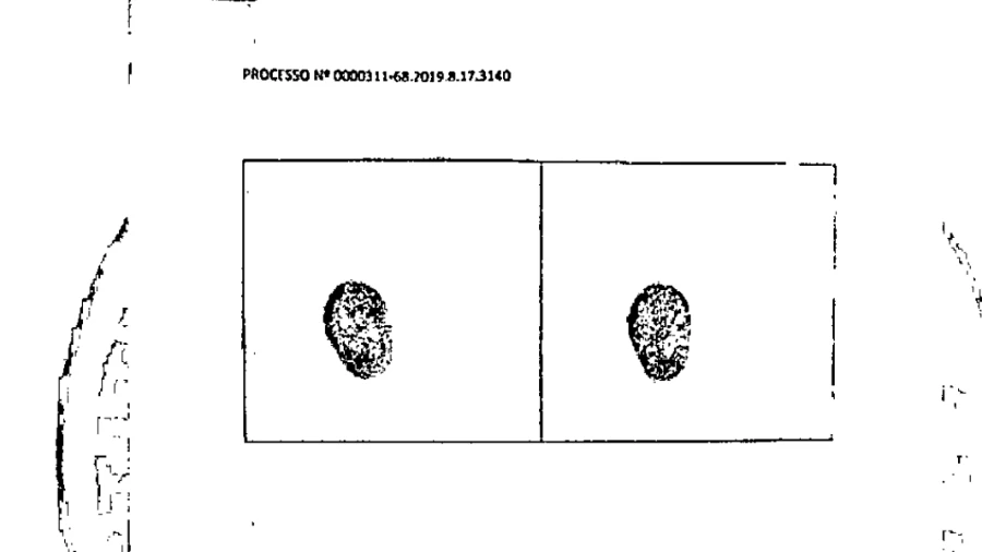 Perícia já indicava suspeita de fraude em biometria no INSS em 2021