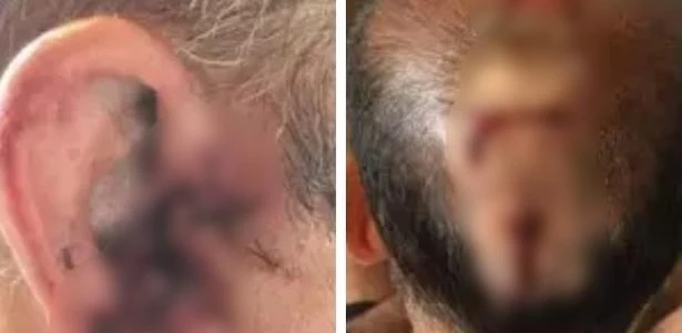 Rio: professor é agredido na cabeça e leva 100 pontos; suspeito é detido