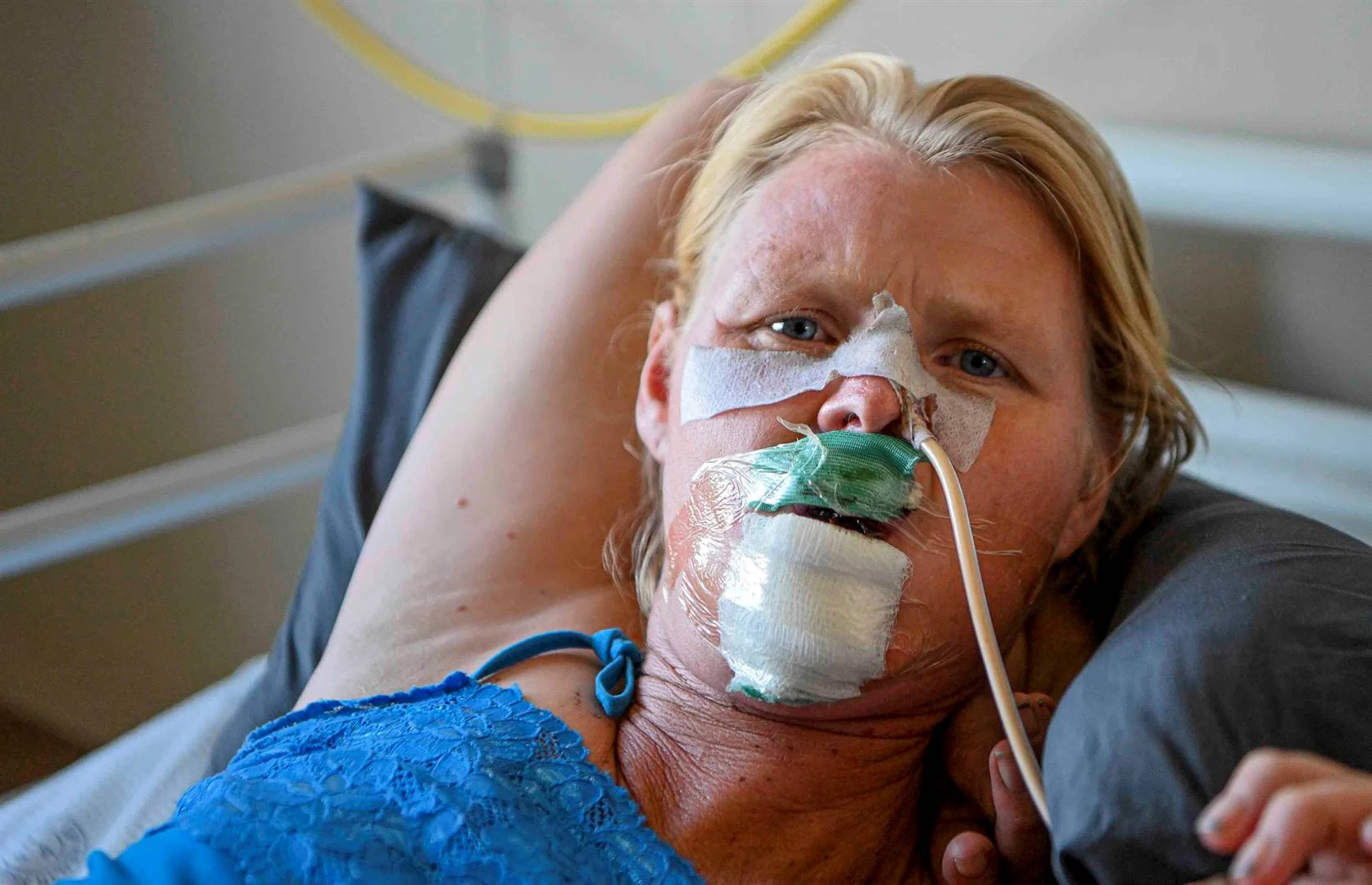 Bloem-vrou sterk goed aan nadat lip toe darem nie afgebyt is