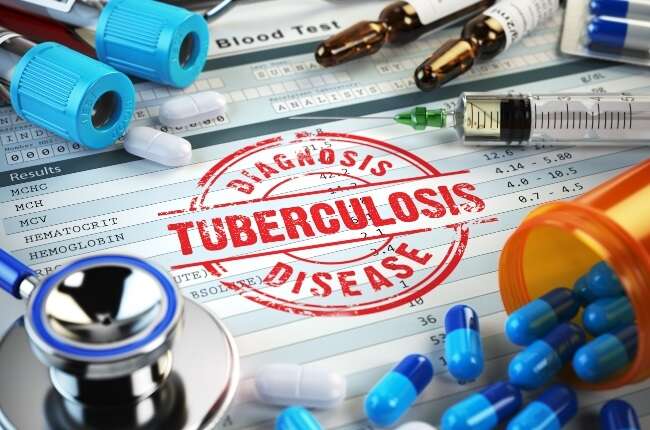 Faster tests, shorter treatments: How new tech could help slow down drug-resistant TB