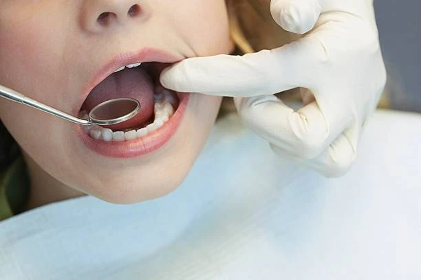 VSA wil voorskryf van fluoried-middels vir kinders verbied