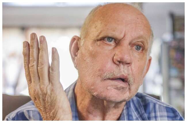 Benoni man’s surgery is botched by dodgy US surgeon: ‘Most of my tumour is still there’