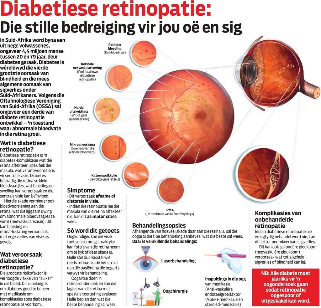 Diabetiese retinopatie: Dis wat jy moet weet