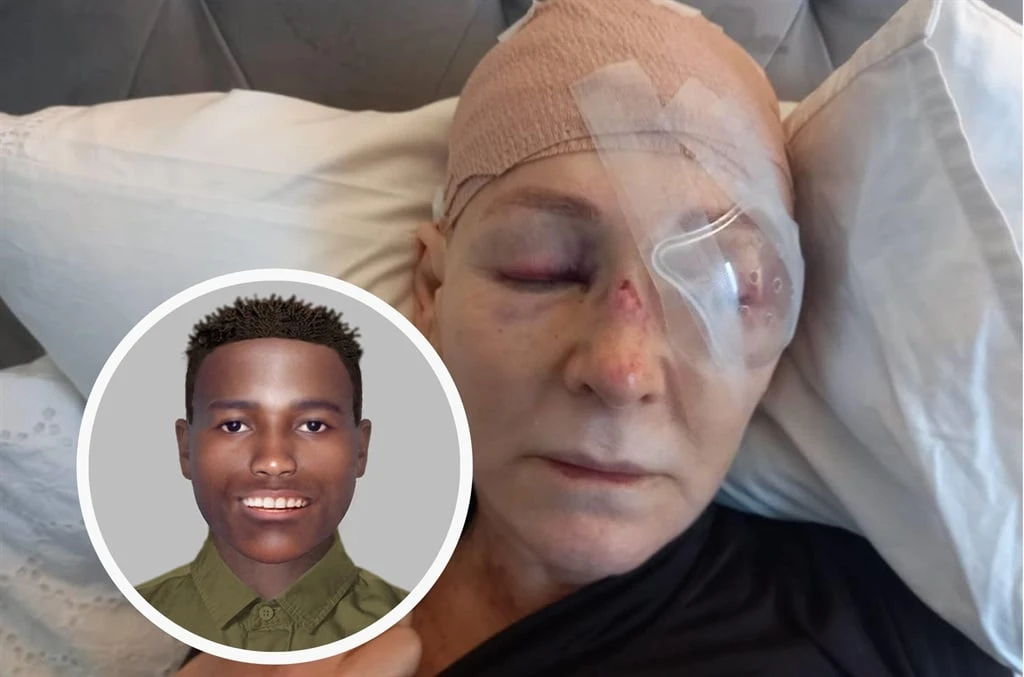 Só lyk man wat glo Kampsbaai-vrou se oog op Tafelberg wou uitkrap