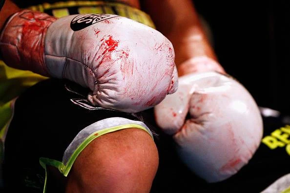 Strenger veiligheidsreëls ná dood van 2 boksers weens breinbeserings