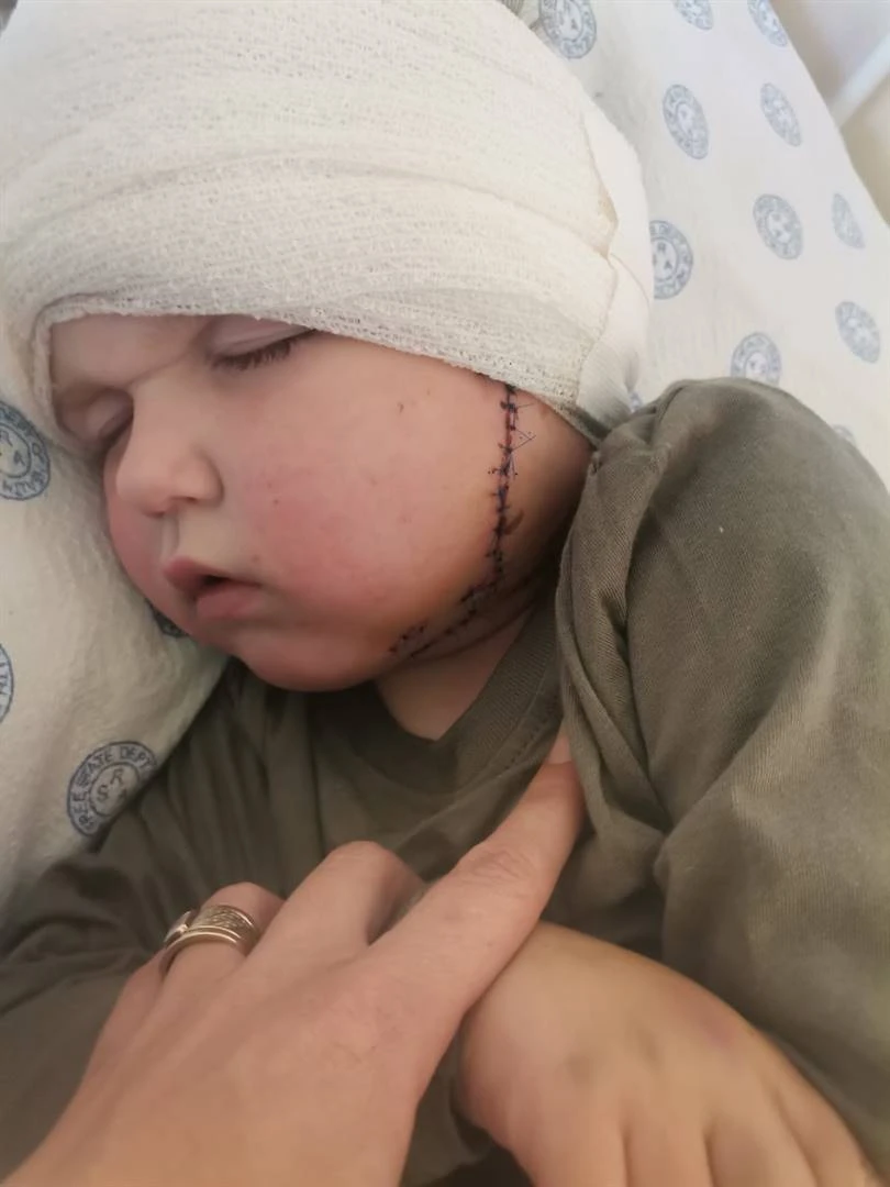 Bloemfonteinse seuntjie (4) veg dapper ná hondeaanval