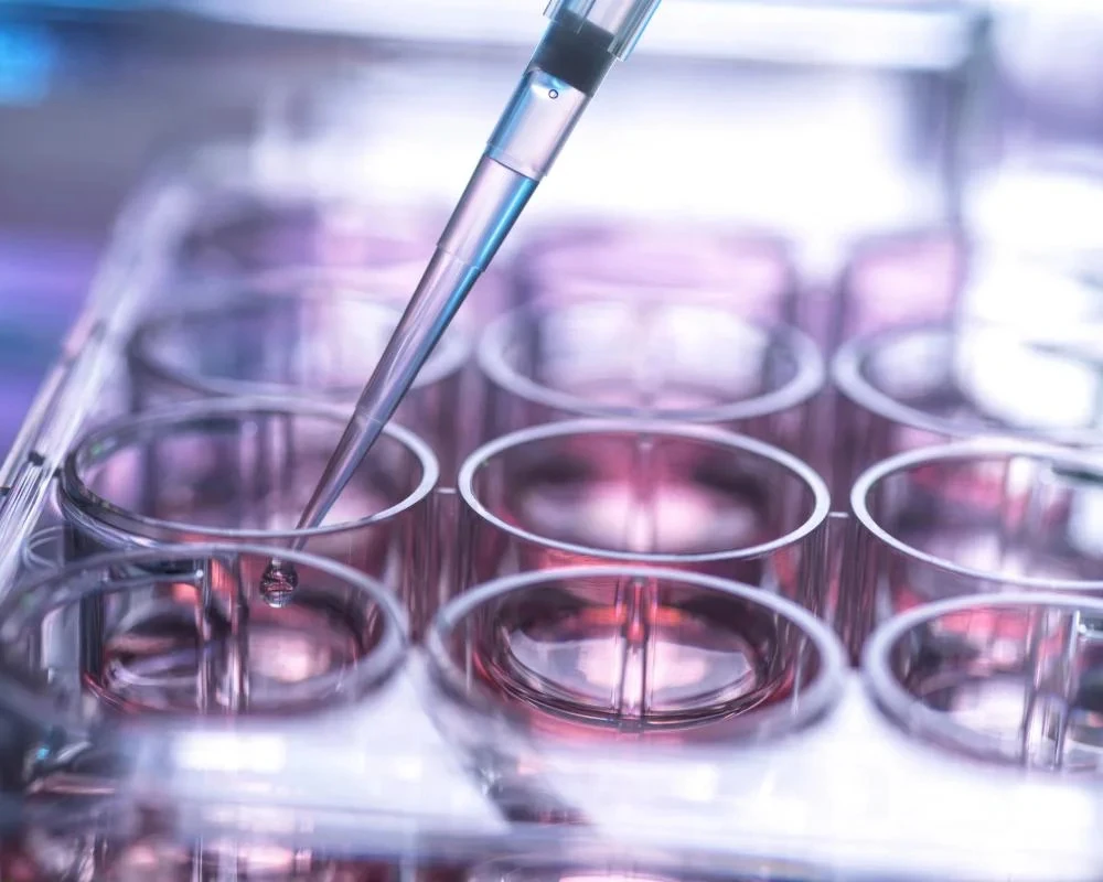 UK’s stem cell transplant system may be putting lives at risk, report by MPs finds