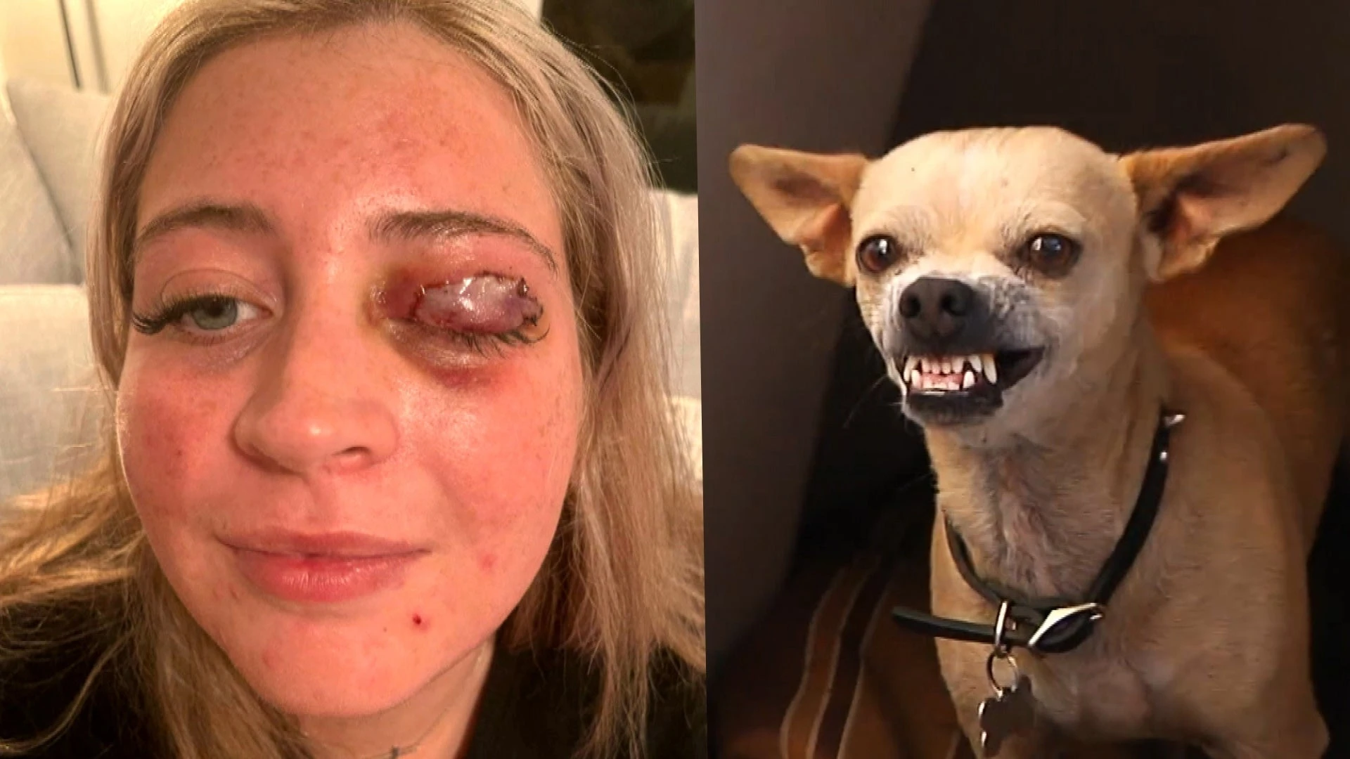 Woman’s eyelid ripped off by stylist’s chihuahua