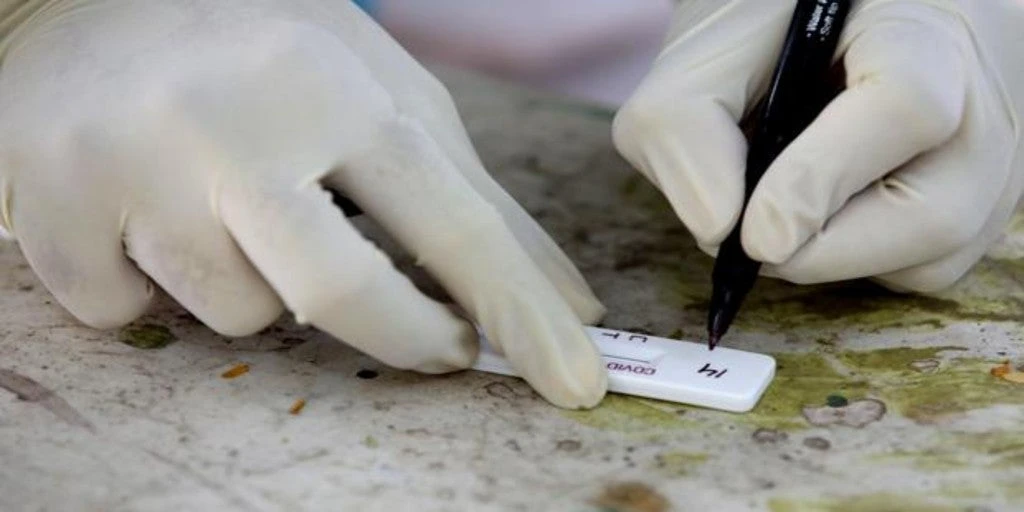 Oxford trabaja en el test de antígenos que diagnostica el Covid en cinco minutos 