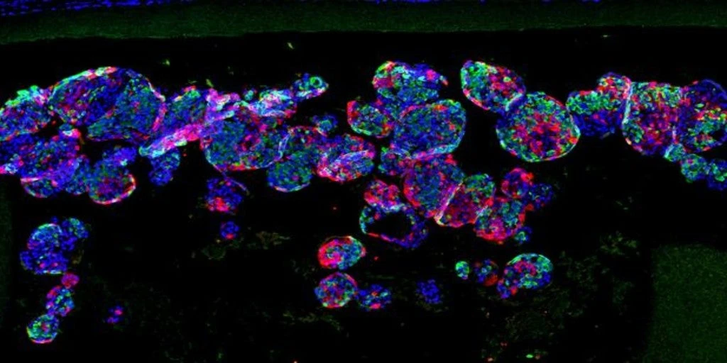 Un mini implante cura la diabetes en ratones sin desencadenar rechazo
