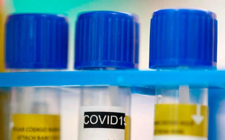 Waterloo Region COVID-19 numbers remain high as most of Ontario continues to get better