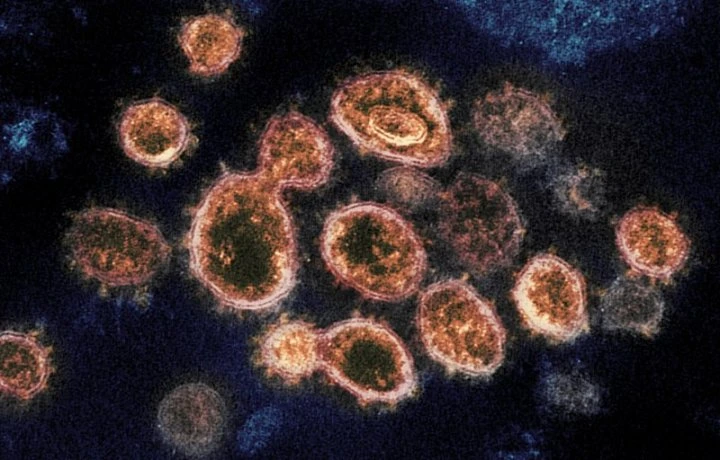 76 COVID-19 cases now connected to outbreak in Waterloo Region congregate setting