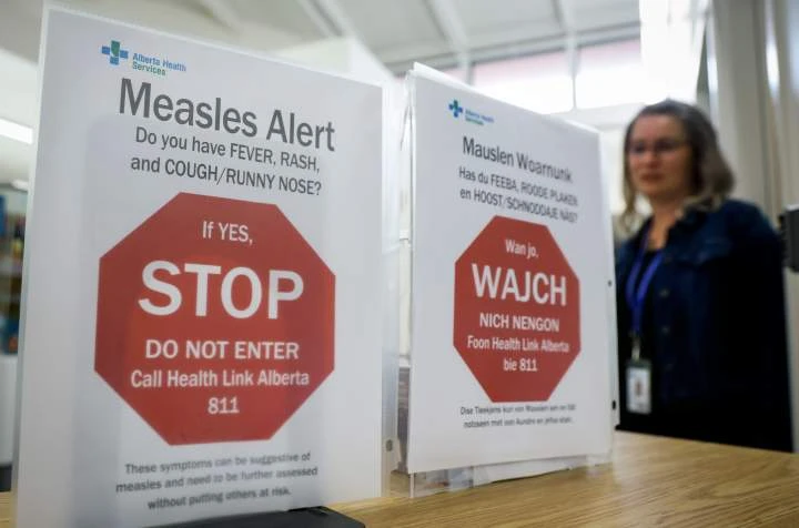 The largest measles outbreak in the U.S. is over. Where does Canada stand?