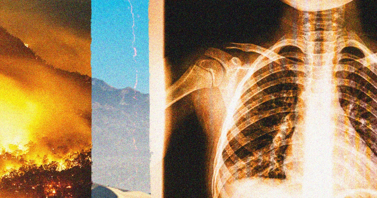 California could face another record-breaking year of Valley fever 