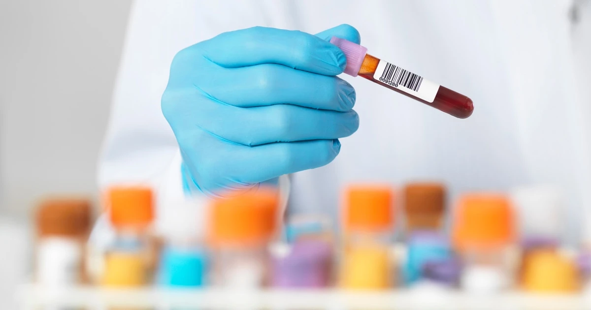 New cholesterol drug lowers LDL when statins aren’t enough, study finds