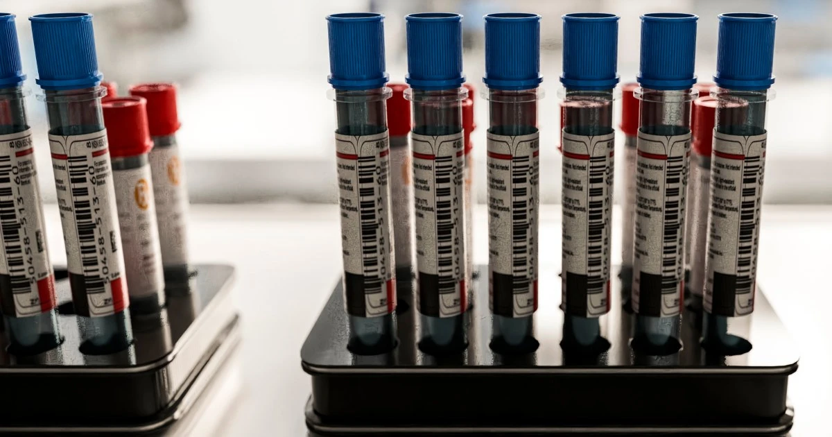 Patients say they want Alzheimer’s blood tests. Doctors aren’t sure they help.