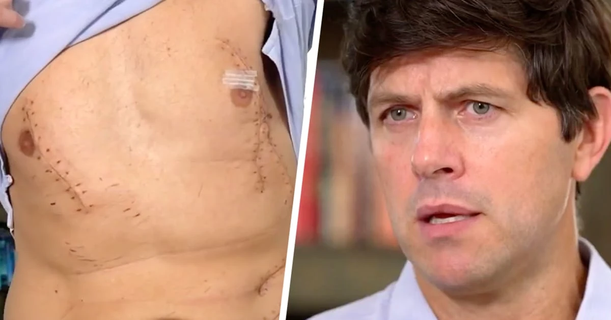 California shark attack survivor recalls 'tussling' with animal and screaming for help