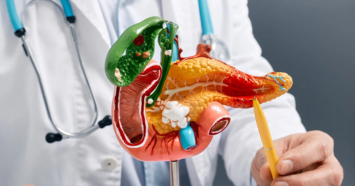 One-size-fits-all pancreatic cancer vaccine showed promise in early trial