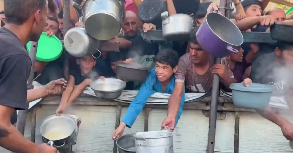 UN: 9% of Gaza’s children have severe malnutrition