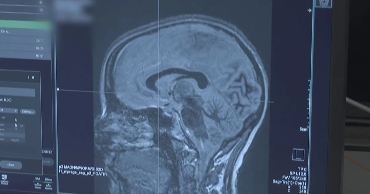 New technology offers hope for Parkinson’s patients