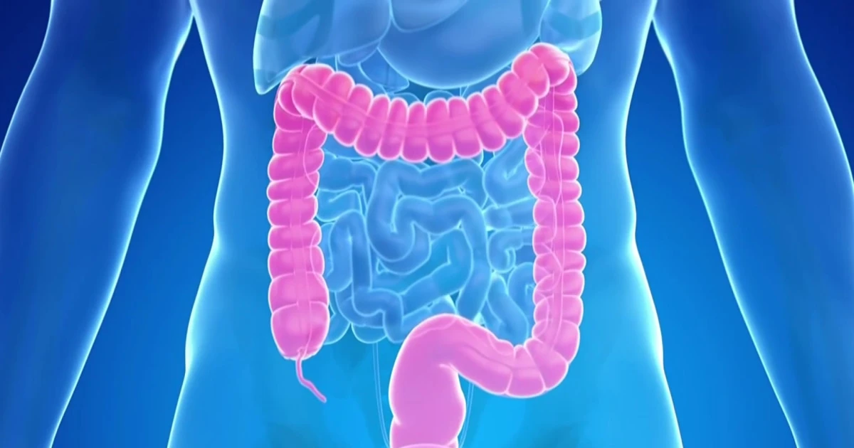 New blood test is added an an option for colorectal cancer screenings