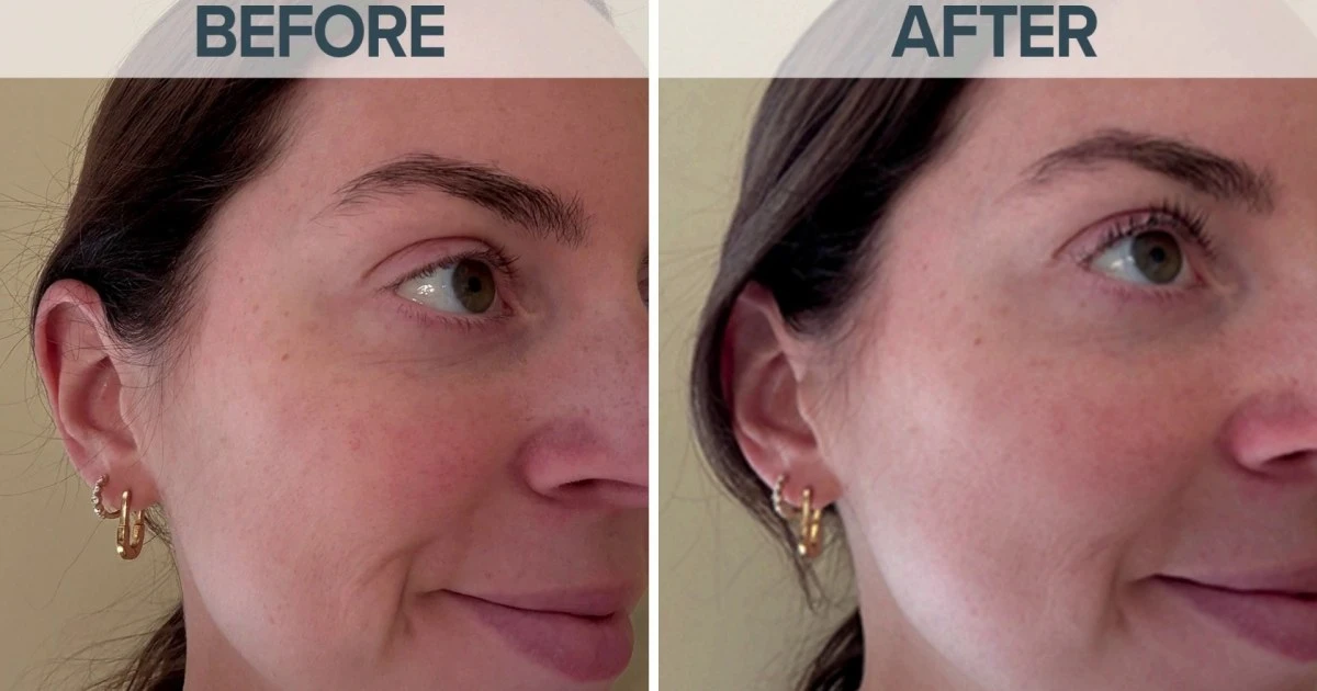 Dermatologist Shares Benefits of Peptides for Skincare Routine