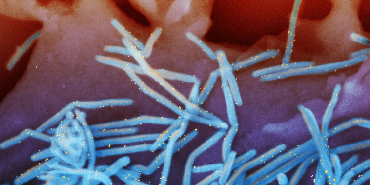 Virus that usually spreads in cold weather sending babies to the hospital in summer