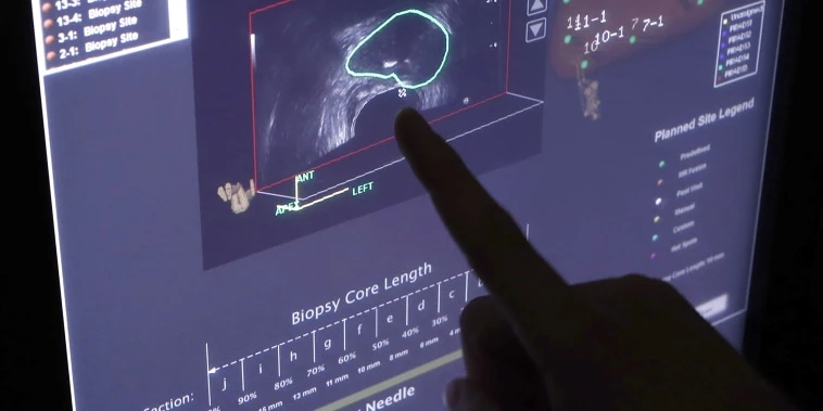 FDA approves new imaging tool to find advanced prostate cancer