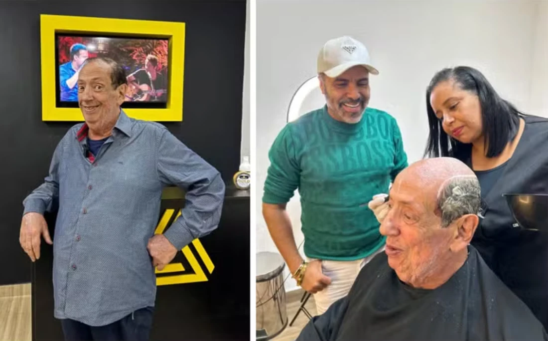 Após ganhar casa doada por Marieta Severo, 'Beiçola' passa por procedimento estético