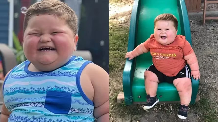 Doença rara faz criança de 3 anos pesar 45 kg e chorar de fome o dia inteiro