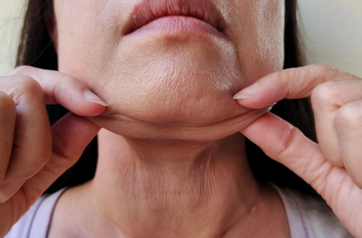 Quer acabar com a papada? Conheça 10 dicas para perder gordura no pescoço