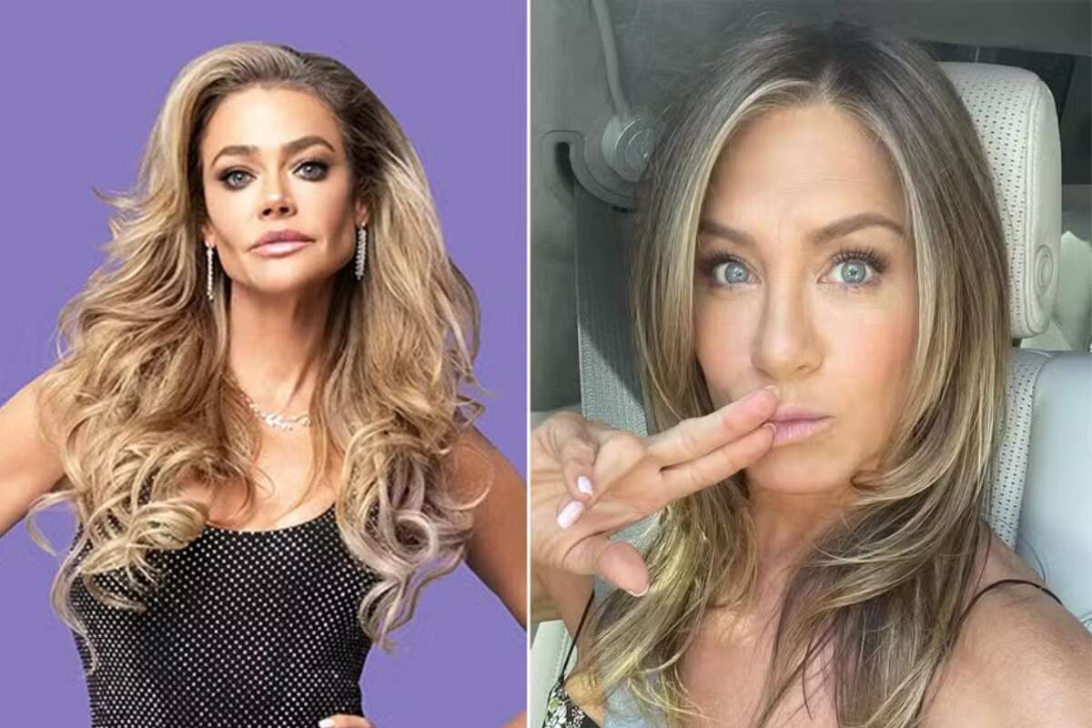 Denise Richards revela inspiração para tratamento facial com esperma de salmão: 'Se ela faz, eu faço'