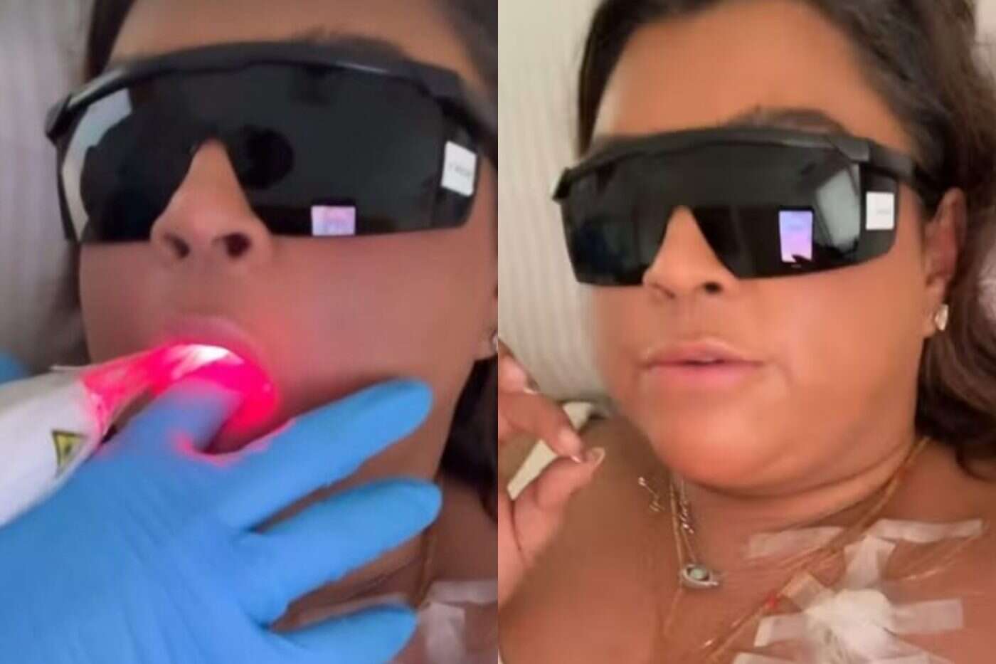 Preta Gil faz terapia com laser dentro da boca durante tratamento de câncer