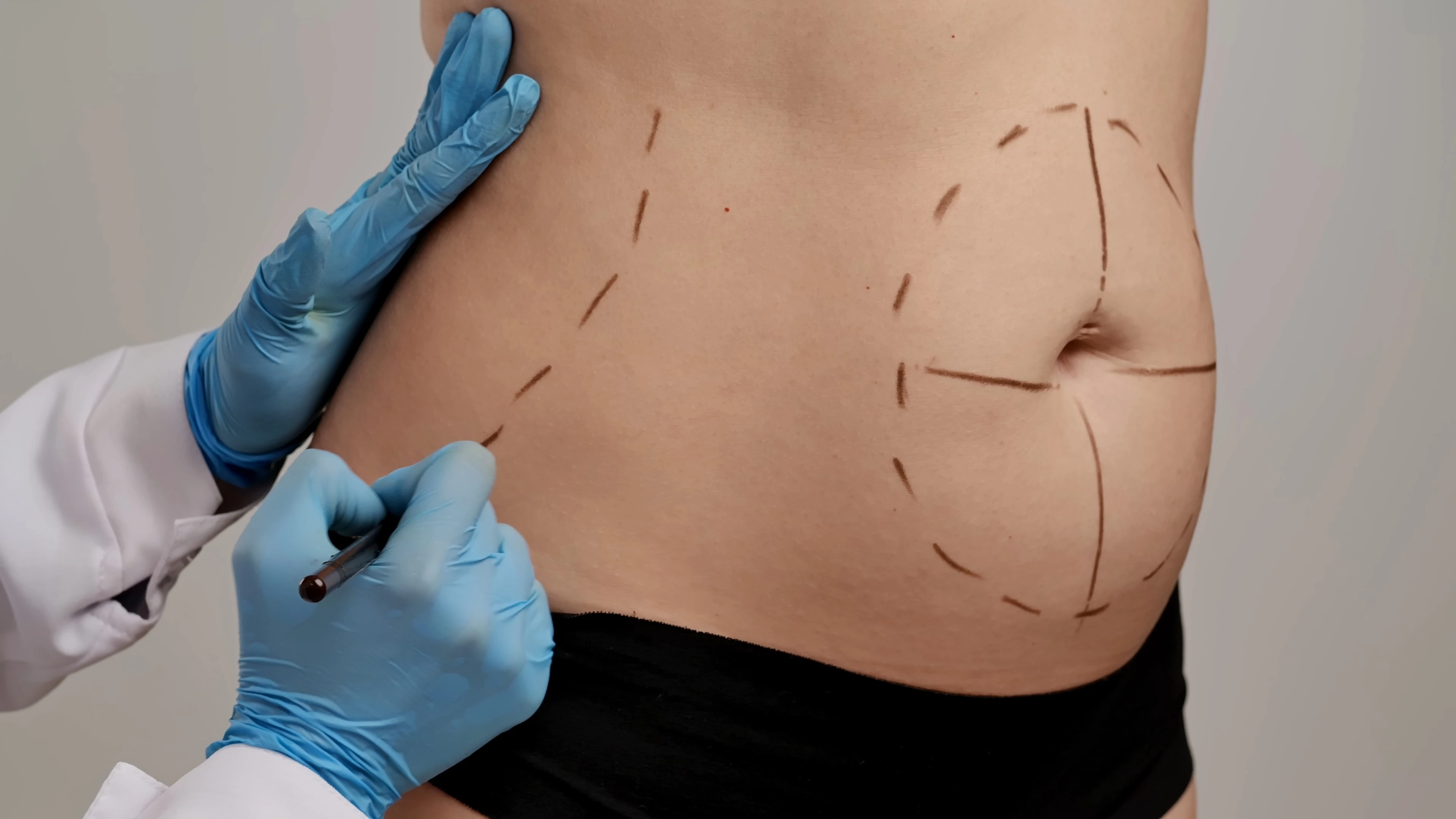 Cirurgia plástica segura: 7 dicas essenciais antes do procedimento