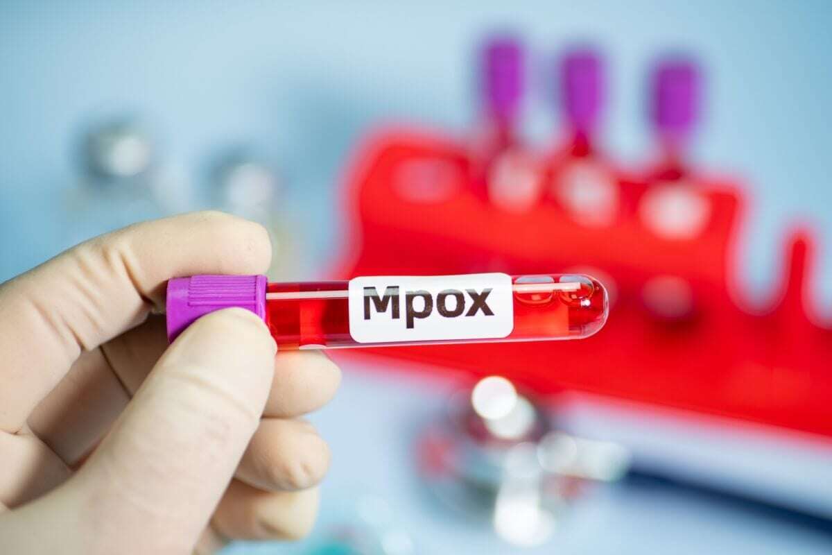 Veja os sintomas e as formas de prevenção contra a mpox