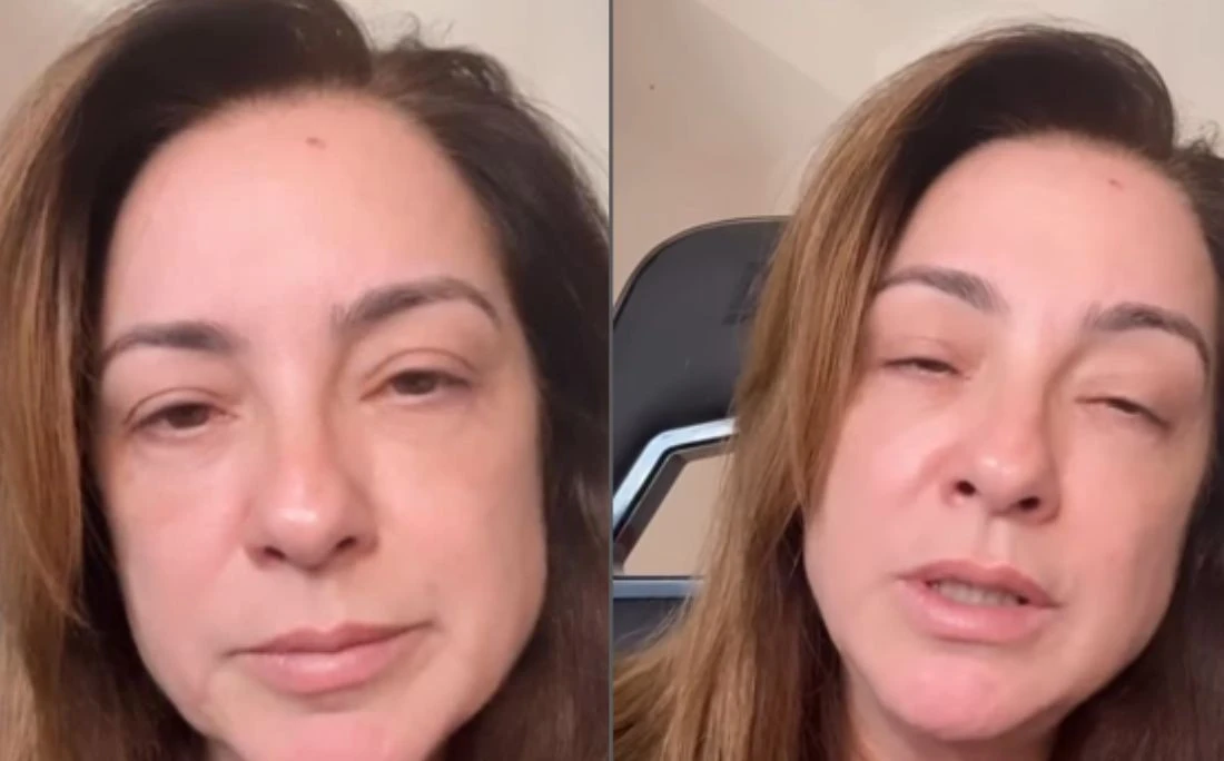 Mulher que espremeu 'espinha' que não cicatrizava nunca descobre câncer e faz alerta