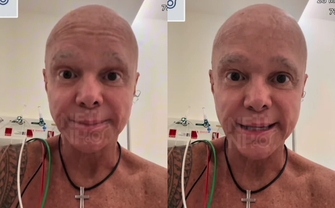 Em tratamento contra o câncer, Netinho diz que levou 128 injeções: 'Barriga está uma peneira'