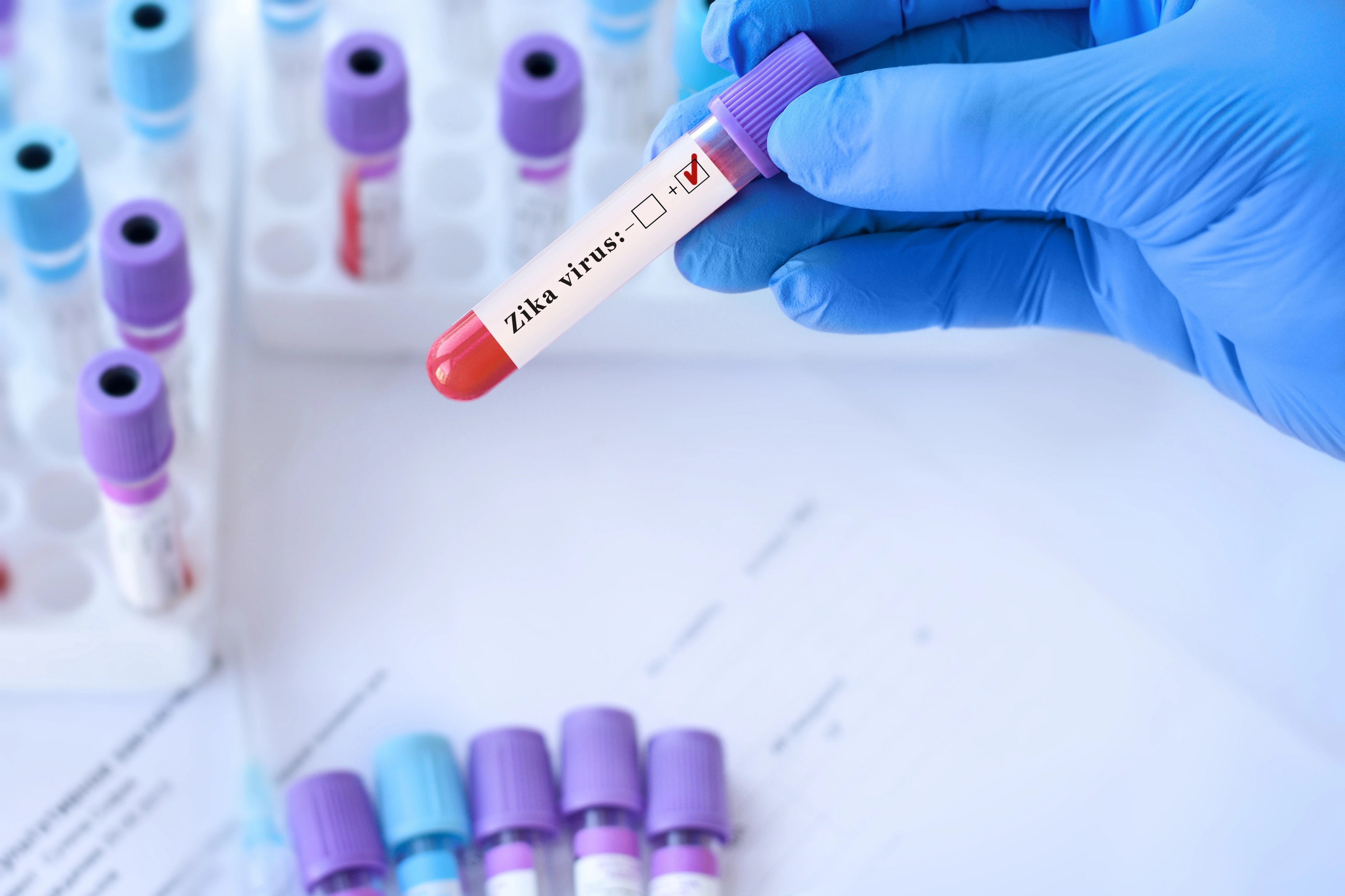 MP não é votada no prazo e famílias de crianças afetadas por zika vivem incerteza sobre indenização