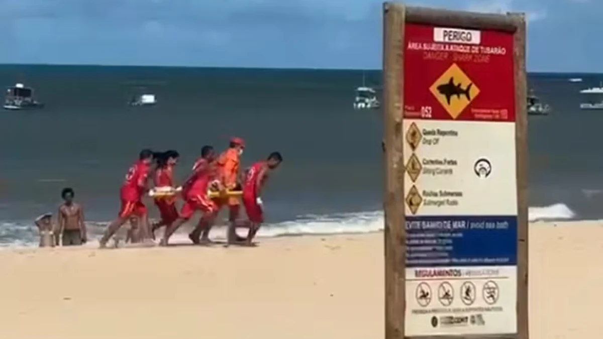 Menino de 11 anos perde a perna após ataque de tubarão em praia de Pernambuco