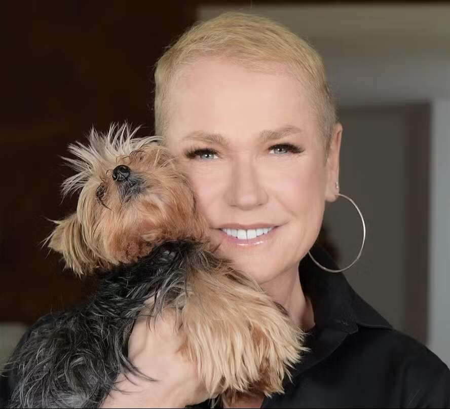 Calvície? Dermatologista explica doença que fez Xuxa optar por implante capilar