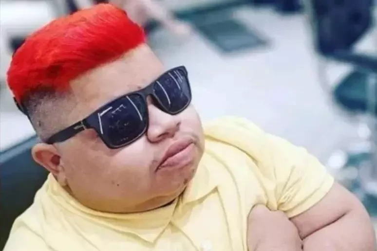 Humorista Gordinho Maniçoba morre aos 27 anos: 'Tentando ser forte'