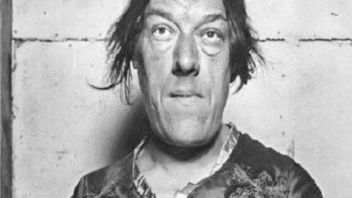 Mary Ann Bevan: a história comovente por trás do cruel título de 'mulher mais feia do mundo'