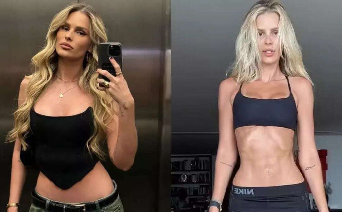 14kg mais magra, Yasmin Brunet revela diagnóstico de doença: 'Eu gritava de dor'