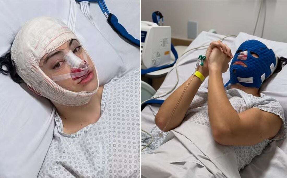 Influencer Zé Longuinho faz cirurgia para deixar rosto com traços femininos; veja