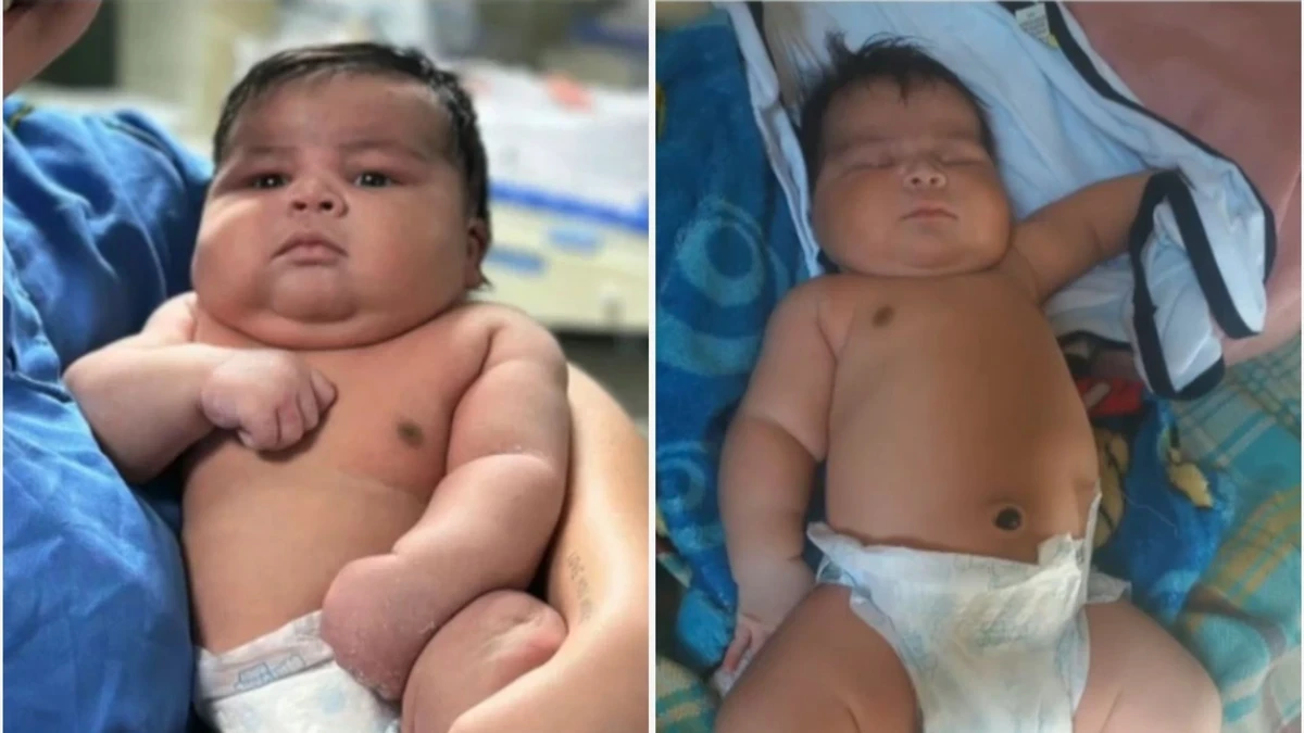 Bebê de 6,5 kg nasce de parto normal, sofre sequelas e a mãe precisa de 55 pontos